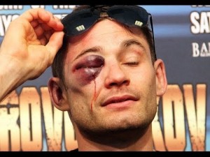 Algieri EYe
